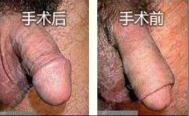 ��Ƥ�^�L��������g(sh��)��